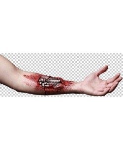 PROTESIS  BRAZO ROBOTIZADO