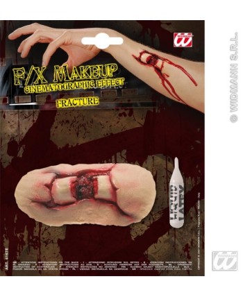 F/X FRACTURA CON ADHESIVO